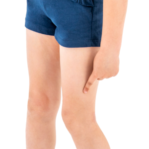 Appareils orthopédiques des membres inférieurs