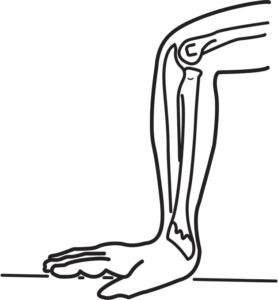 Złamanie nadgarstka